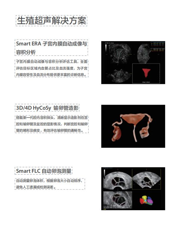 新时代的“女娲”传说——专为妇幼健康打造的超声设备