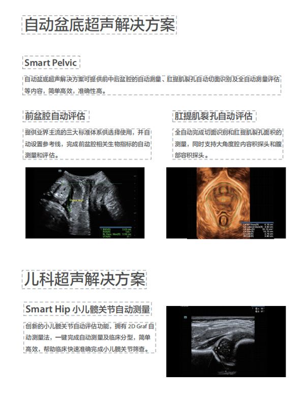 新时代的“女娲”传说——专为妇幼健康打造的超声设备