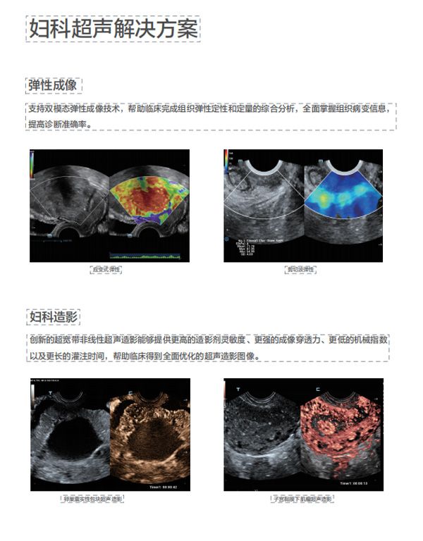 新时代的“女娲”传说——专为妇幼健康打造的超声设备